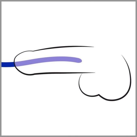 Silicone Dilator Set Silicone Dilator Set